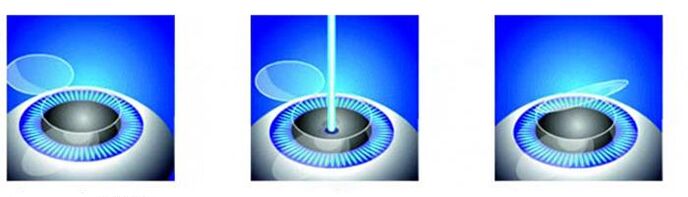 Power correction phases of vision